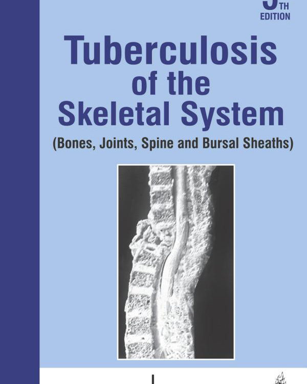 Tuberculosis of the Skeletal System