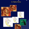 Atlas Of Ossiculoplasty