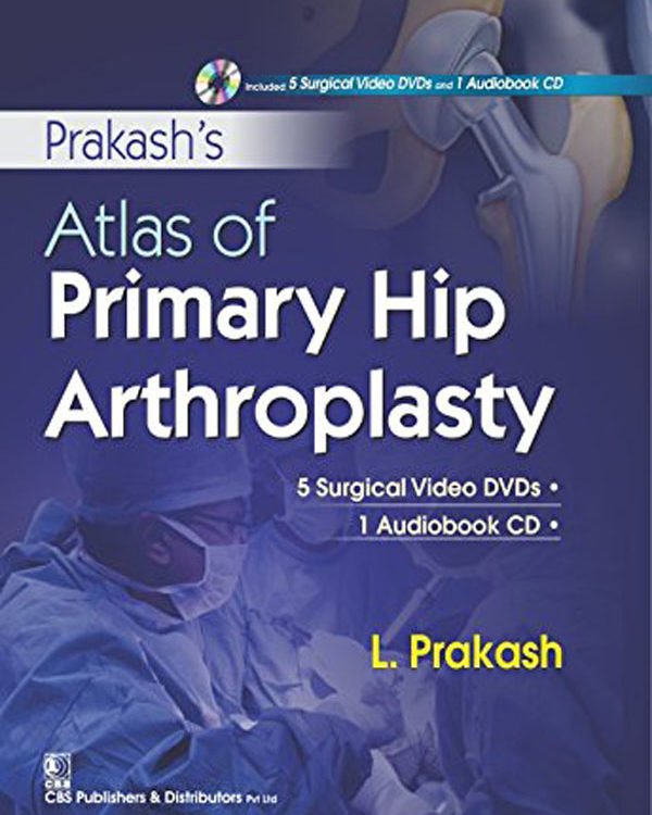 Prakash Atlas of Primary Hip Arthroplasty