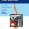 The ASSI Monographs: Lumbar Spinal Stenosis