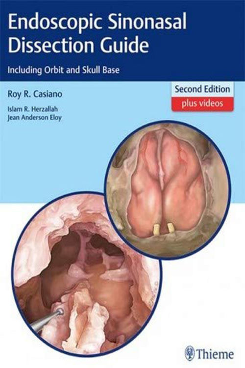 Endoscopic Sinonasal Dissection Guide Paperback