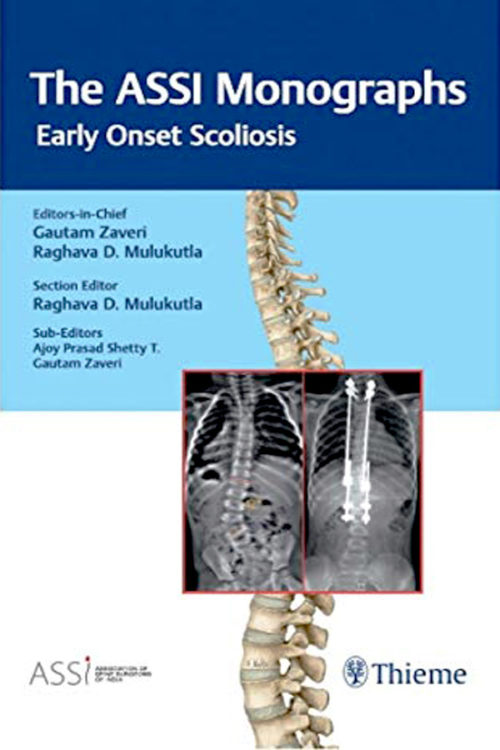 The ASSI Monographs: Early Onset Scoliosis