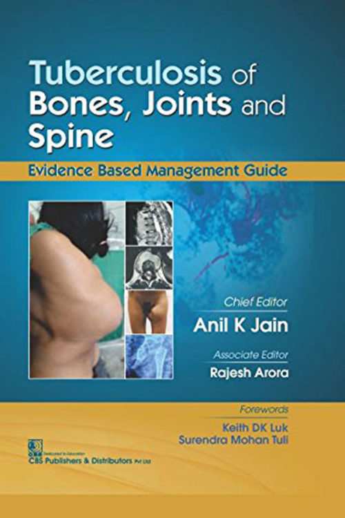 Tuberculosis Of Bones, Joints and Spine