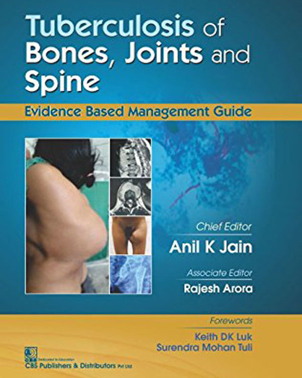 Tuberculosis Of Bones, Joints and Spine