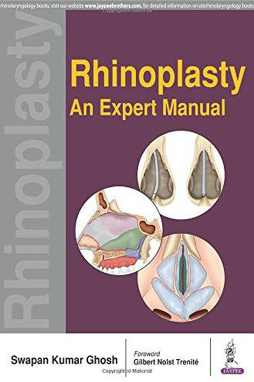 Rhinoplasty An Expert Manual