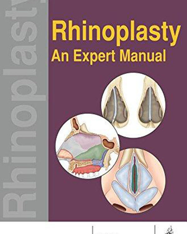 Rhinoplasty An Expert Manual