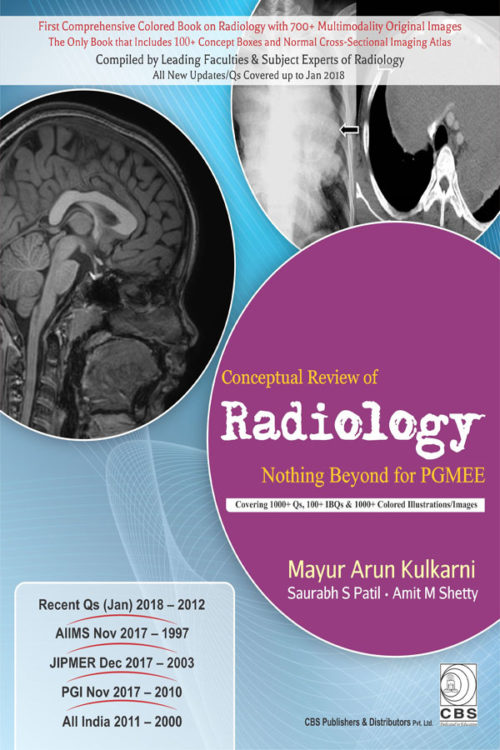Conceptual Review of Radiology : Nothing Beyond for PGMEE