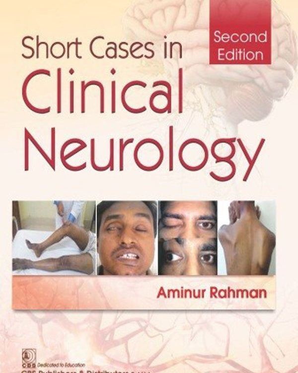 Short Cases in Clinical Neurology