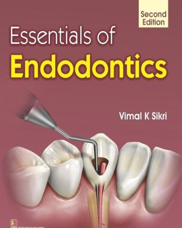 Essentials Of Endodontics