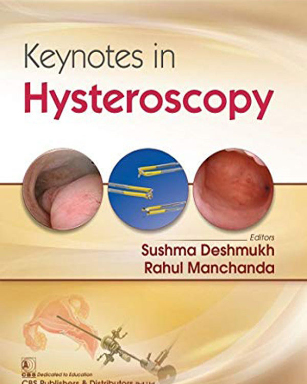 Keynotes in Hysteroscopy