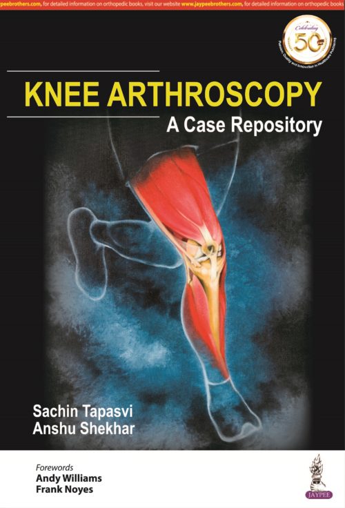 KNEE ARTHROSCOPY A Case Repository 1st Edition 2019
