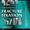 fracture