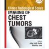 Clinico Radiological Series Imaging of Chest Tumors