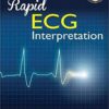 Rapid ECG Interpretation