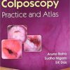 Colposcopy—Practice and Atlas