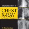 Interpretation of Chest X-Ray: An Illustrated Companion