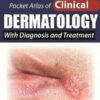 Pocket Atlas of Clinical Dermatology