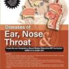 DISEASES OF EAR, NOSE & THROAT