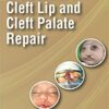 Art And Science Of Cleft Lip And Cleft Palate Repair