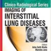 Clinico Radiological Series:Imaging Of Interstitial Lung Diseases