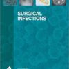 Surgical Infections