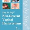 Step by Step Non-Descent Vaginal Hysterectomy