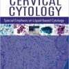 Handbook of Cervical Cytology: Special Emphasis on Liquid Based Cytology