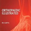 Orthopedics Illustrated