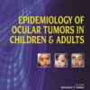 Epidemiology Of Ocular Tumors In Children & Adults