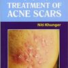 Step by Step: Treatment of Acne Scars