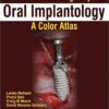 Treatment Planning Steps In Oral Implantology:A Color Atlas