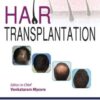 Hair Transplantation
