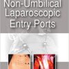 NON-UMBILICAL LAPAROSCOPIC ENTRY PORTS