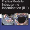 Practical Guide to Intrauterine Insemination (IUI)