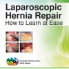 Laparoscopic Hernia Repair: How to Learn at Ease