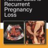 PRACTICAL GUIDE TO RECURRENT PREGNANCY LOSS