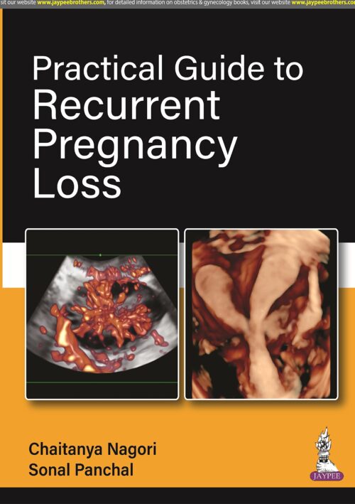 PRACTICAL GUIDE TO RECURRENT PREGNANCY LOSS