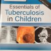 ESSENTIALS OF TUBERCULOSIS IN CHILDREN