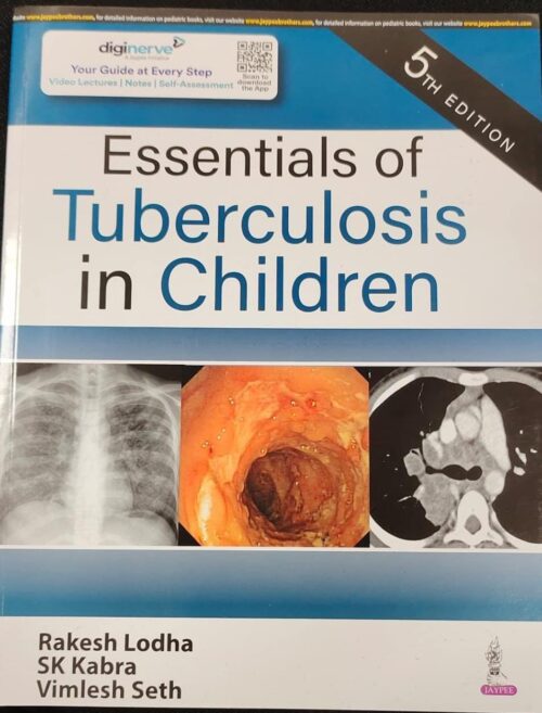 ESSENTIALS OF TUBERCULOSIS IN CHILDREN