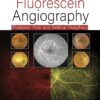 PRACTICAL HANDBOOK OF FLUORESCEIN ANGIOGRAPHY: POSTERIOR AND RETINAL PERIPHERY