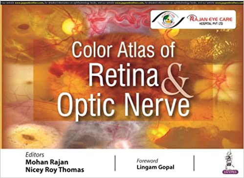 COLOR ATLAS OF RETINA & OPTIC NERVE