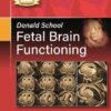 DONALD SCHOOL FETAL BRAIN FUNCTIONING