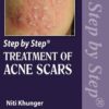 STEP BY STEP TREATMENT OF ACNE SCARS