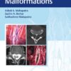 Split Cord Malformations 1st Ed.