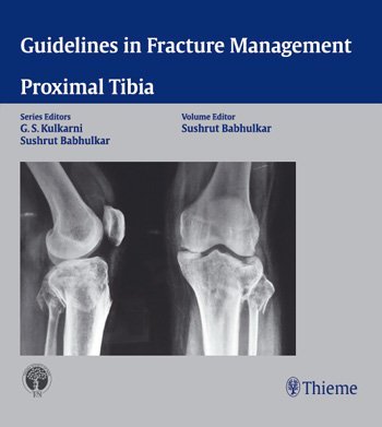 Guidelines in Fracture Management - Proximal Tibia
