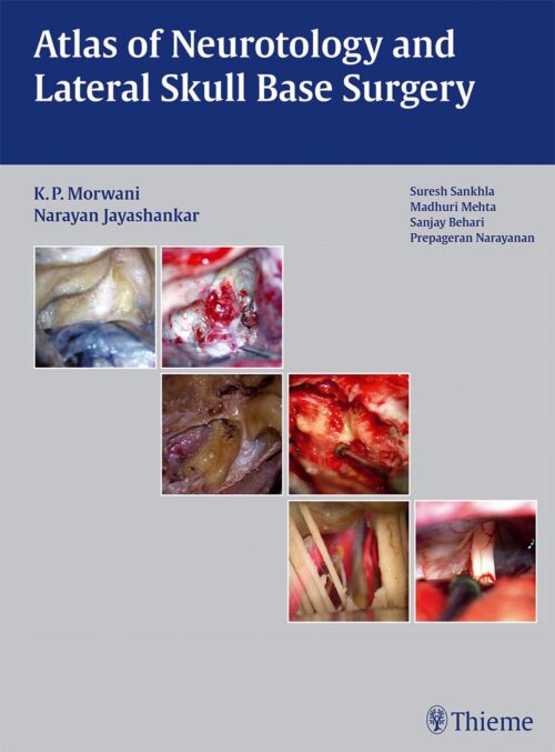 Atlas of Neurotology and Lateral Skull Base Surgery