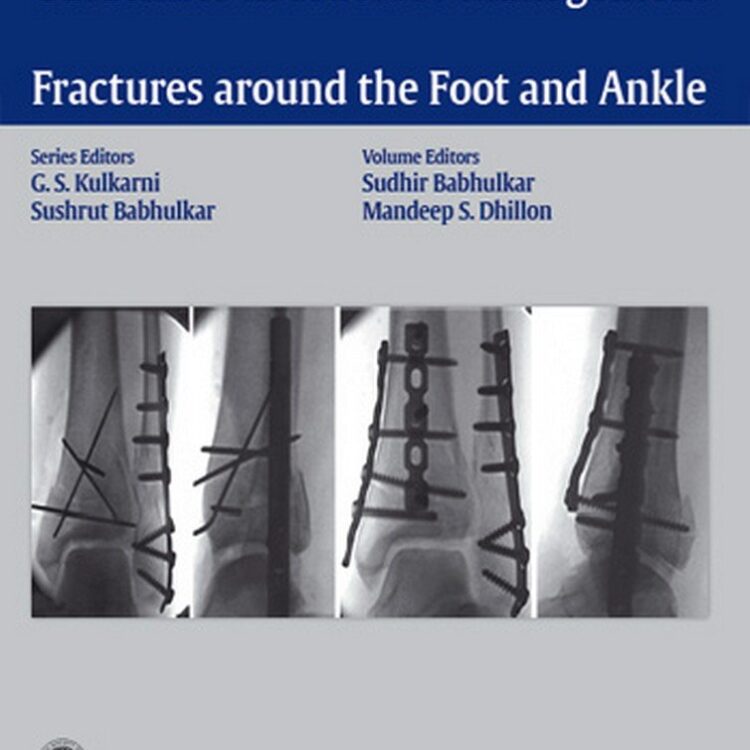Guidelines in Fracture Management- Fractures around the Foot and Ankle