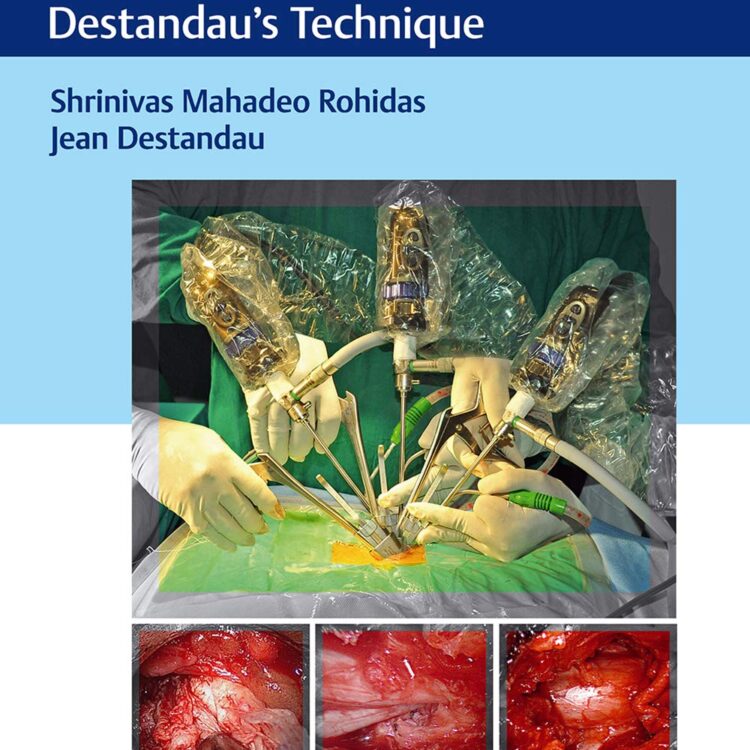 Endoscopic Spine Surgery 1st Edition