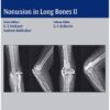 Nonunion in Long Bones-Part II 2016