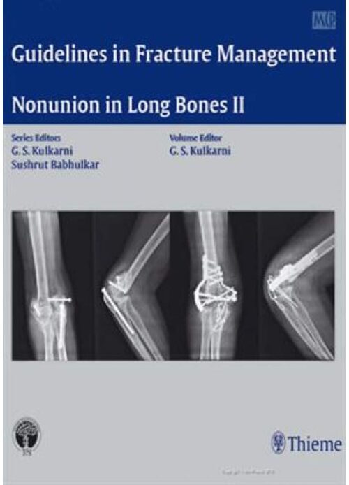 Nonunion in Long Bones-Part II 2016